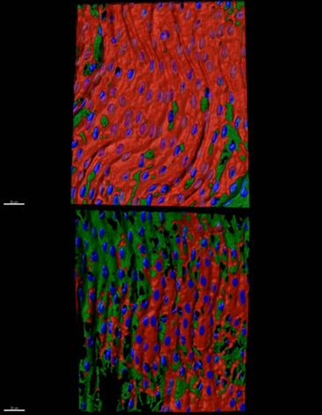 Detecci�n de ILK (rojo), c�lulas endoteliales (verde), en una arteria humana sana (arriba) y una arteria humana ateroscler�tica (abajo)