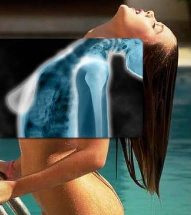 Mujer vista con nueva tecnolog�a de rayos X